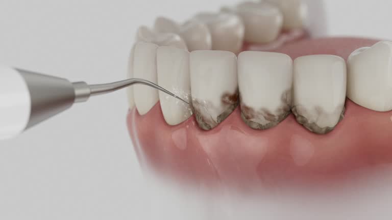 Trusted Invisalign Clear Aligners service in Waukomis, OK - Dentist Open Now